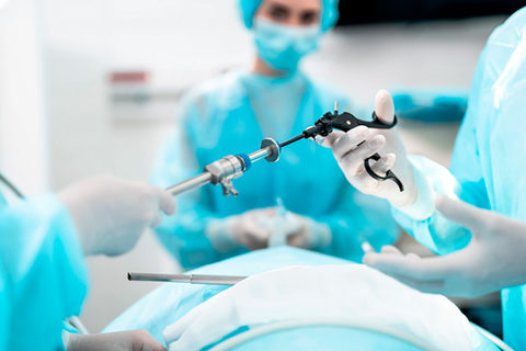 Cirugía laparoscópica